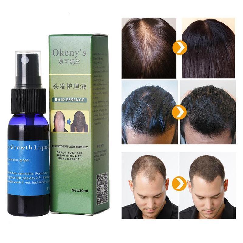 LUMORÉ | Hair Solution (Alopecia Prevention + Strengthening)