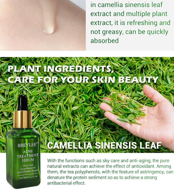 LUMIS | Anti-Acne Treatment Serum (Facial Repair + Oil-Free)