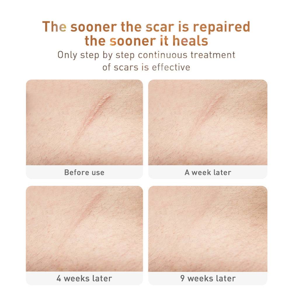 MEIYAN | TCM Repair Cream (Scar Removal + Herbal Care)