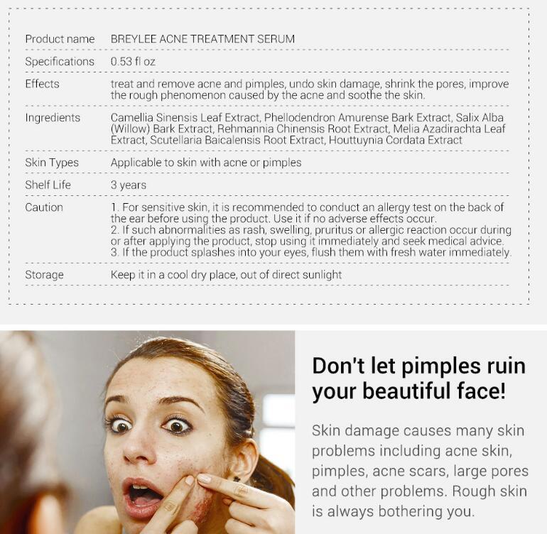 LUMIS | Anti-Acne Treatment Serum (Facial Repair + Oil-Free)
