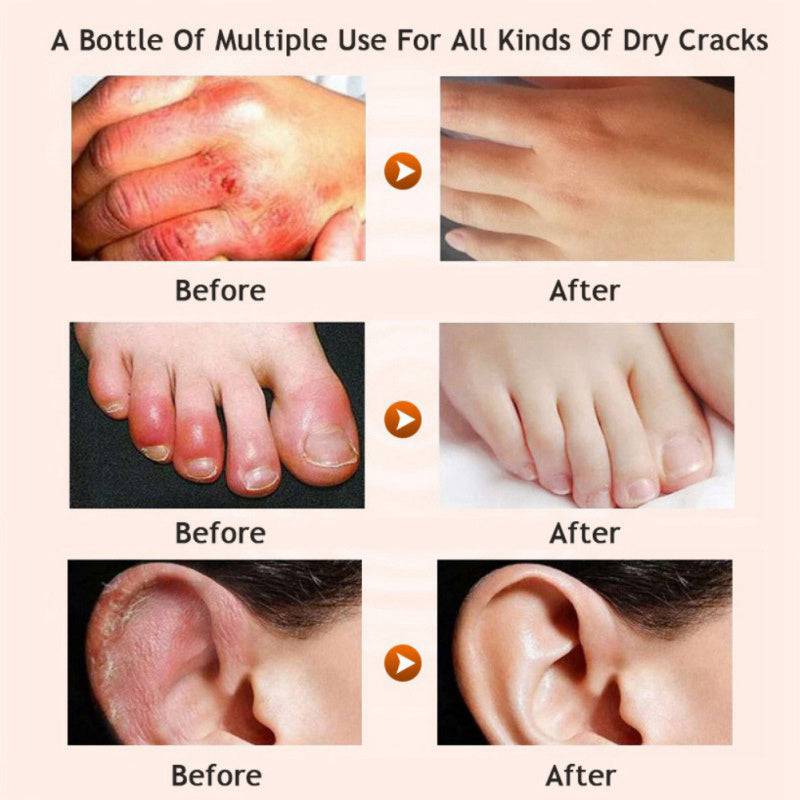 MELORA | Ultra-Repairing Moisturizing Cream (Honey + Urea | Silky Feet and Legs)