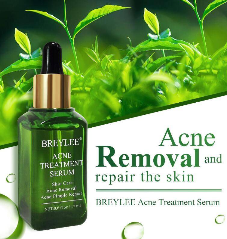LUMIS | Anti-Acne Treatment Serum (Facial Repair + Oil-Free)