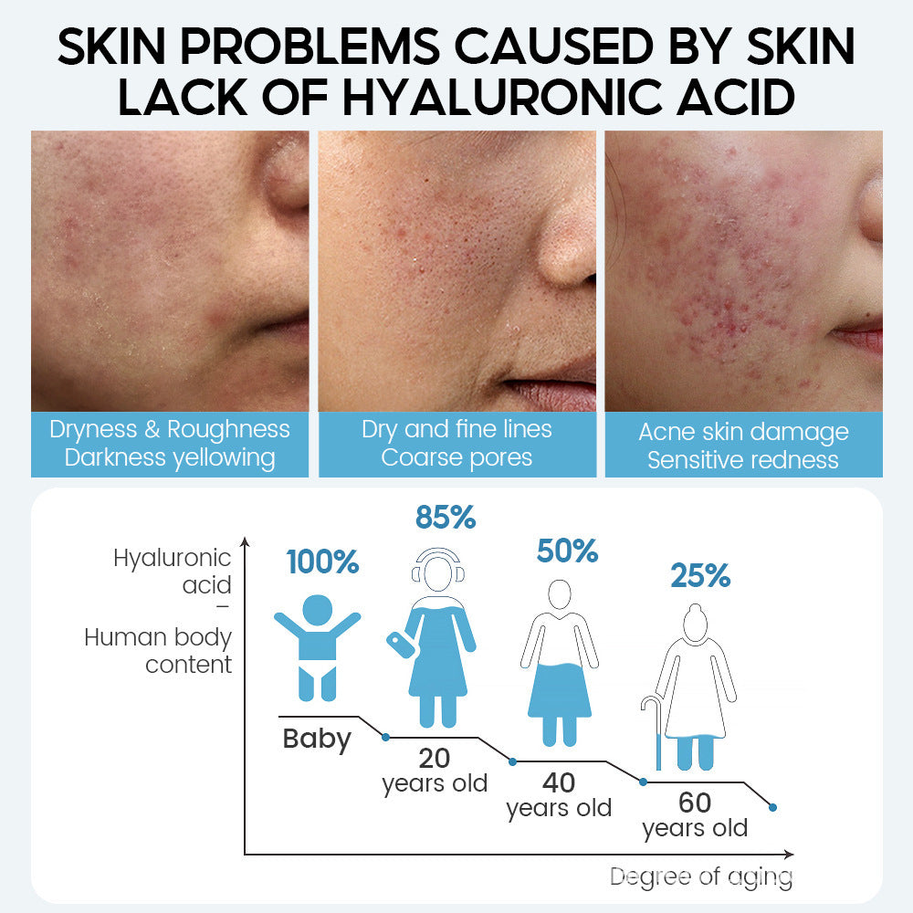 HYALUX | Hyaluronic Acid Facial Serum (Anti-aging + Pore Reducing + Moisturizing)